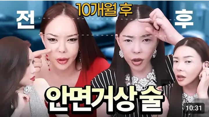 대체 트젠들은 *여성화*를 위해 얼마를 쓸까? | 인스티즈