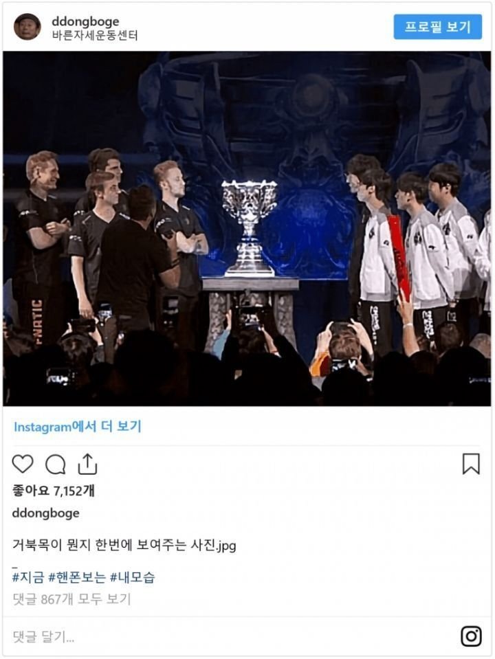  거북목의 확실한 예시1