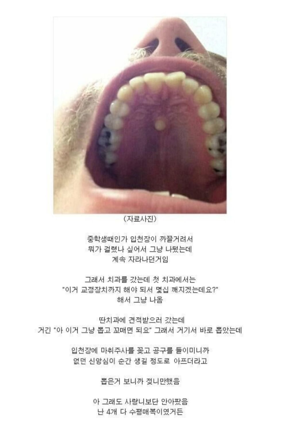 치과에서도 놀란 레전드 이빨 위치 | 인스티즈