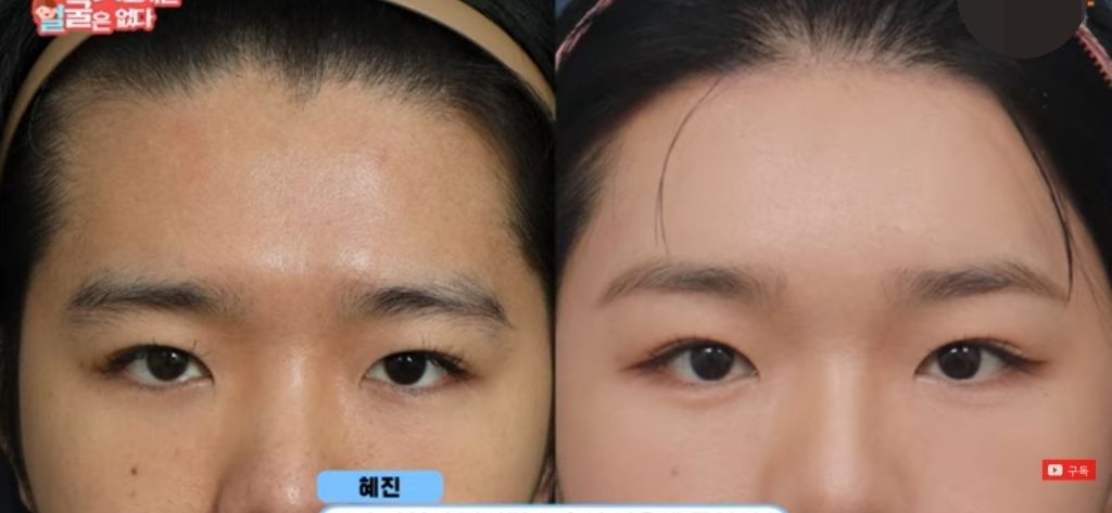 대체 트젠들은 *여성화*를 위해 얼마를 쓸까? | 인스티즈