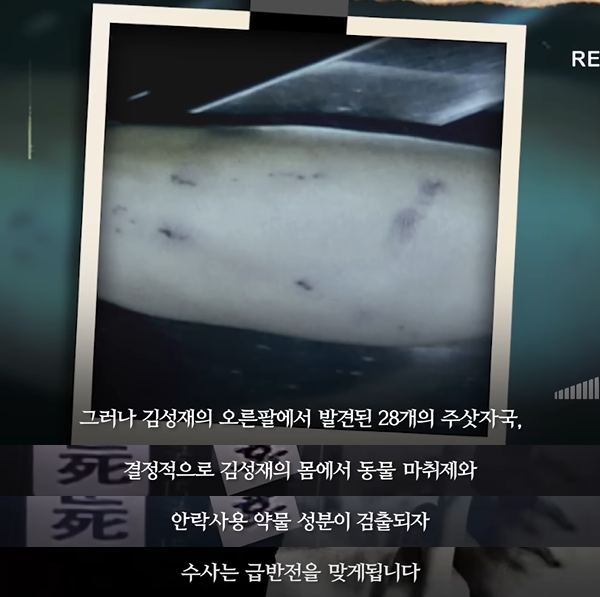 듀스 김성재 팔에서 발견된 28개의 주사자국 | 인스티즈