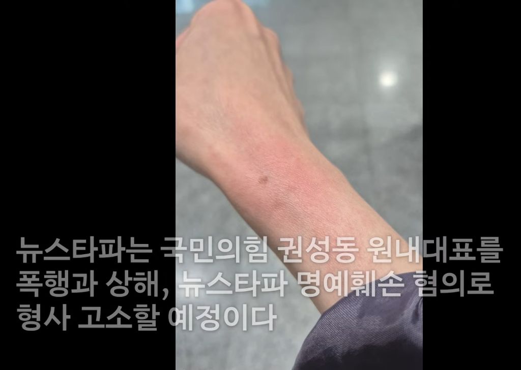 권성동 曰 나도 고소장 낼 거라고 | 인스티즈