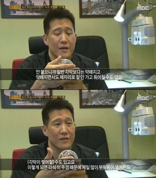 어느 블로거의 라섹 10년차 후기 | 인스티즈