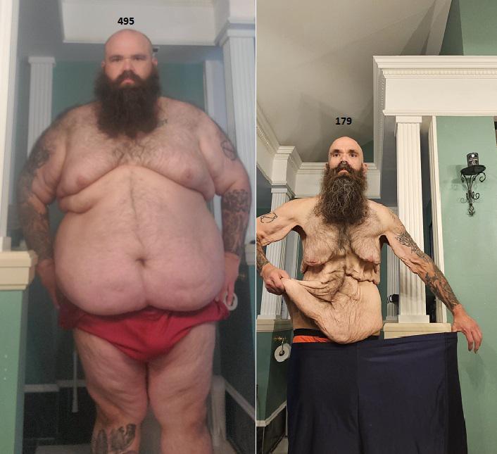 (약혐주의) 225kg 에서 80kg까지 살을 뺀 남자 | 인스티즈