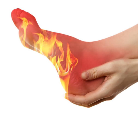  발바닥이 뜨겁고 열이 많다면 족심열