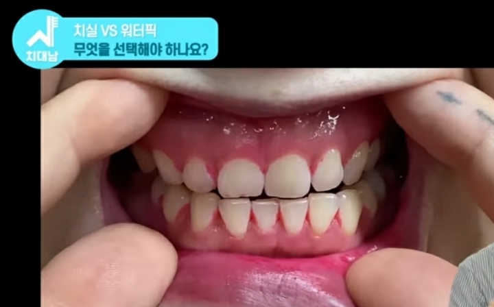 치실 대신 워터픽 쓰면 안됨? 워터픽 이름이 물치실이잖아 | 인스티즈