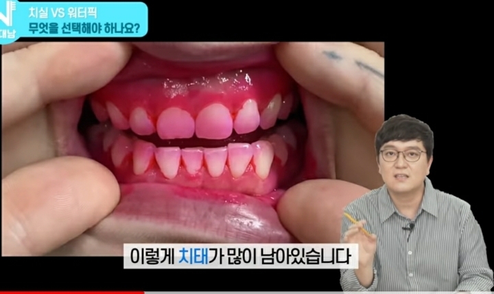 치실 대신 워터픽 쓰면 안됨? 워터픽 이름이 물치실이잖아 | 인스티즈