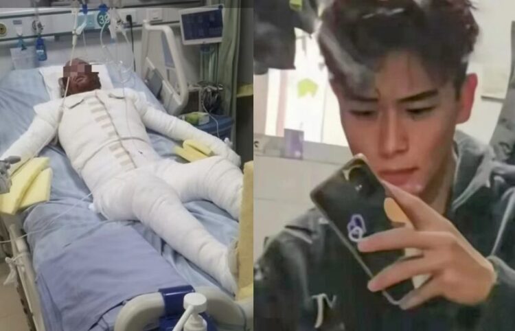  전신 90% 화상”…20대男 집에서 &apos;이것&apos; 충전하다 사고, 무슨 일?