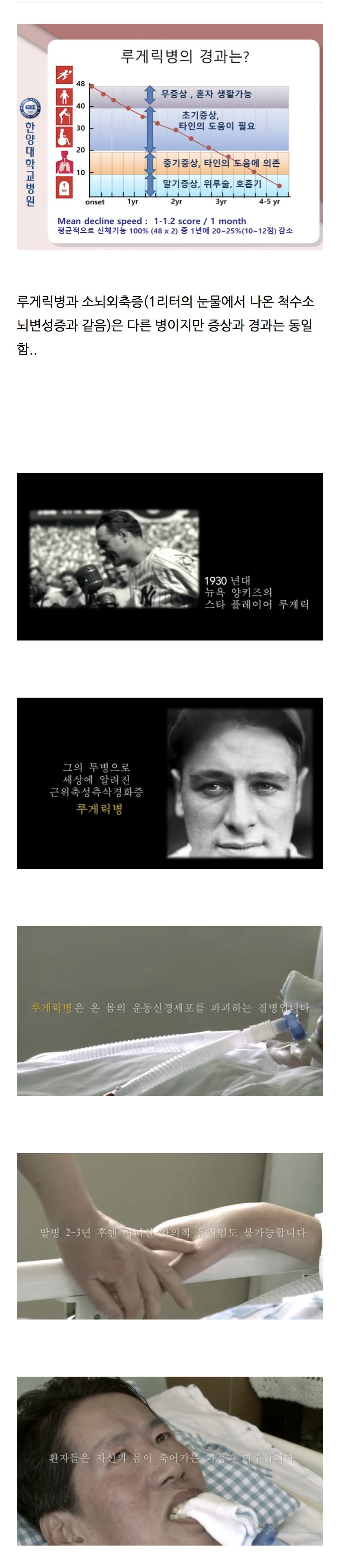  발병시 1/4이 자살한다는 세상에 서 가장 잔인한 병.jpg