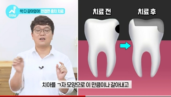 치실 대신 워터픽 쓰면 안됨? 워터픽 이름이 물치실이잖아 | 인스티즈
