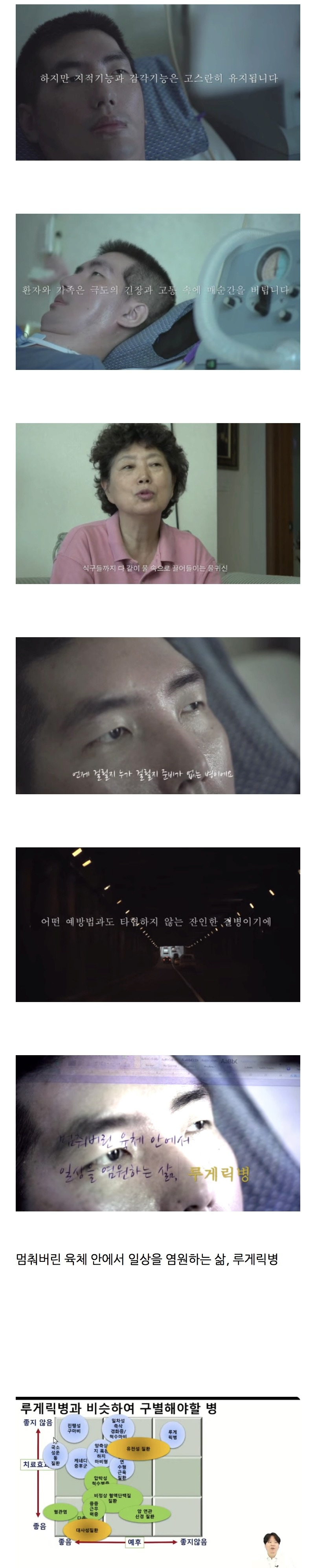 발병시 1/4이 자살한다는 세상에 서 가장 잔인한 병.jpg | 인스티즈