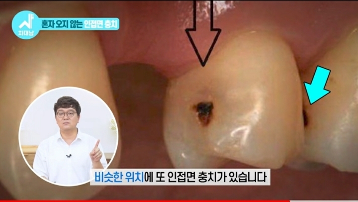 치실 대신 워터픽 쓰면 안됨? 워터픽 이름이 물치실이잖아 | 인스티즈