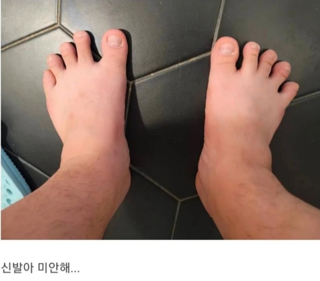 발 볼이 너무 넓은 사람 | 인스티즈