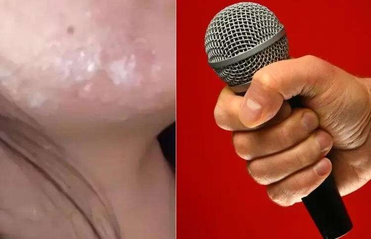  물집이 코, 뺨에도”…노래방서 &apos;이것&apos; 감염돼 8년째 고통받는 女, 무슨 일?11