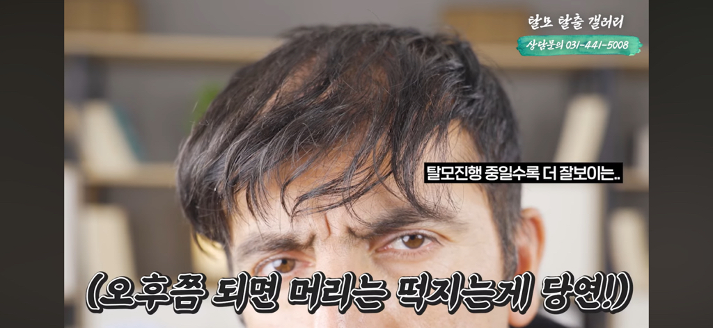 탈모 유튜버가 분석한 한동훈 | 인스티즈