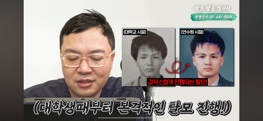 탈모 유튜버가 분석한 한동훈 | 인스티즈