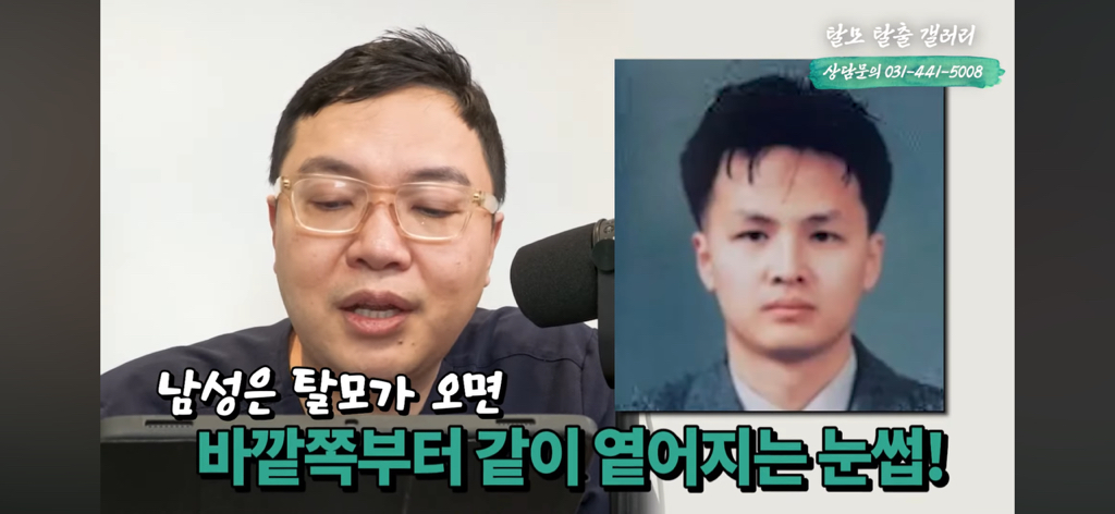  탈모 유튜버가 분석한 한동훈