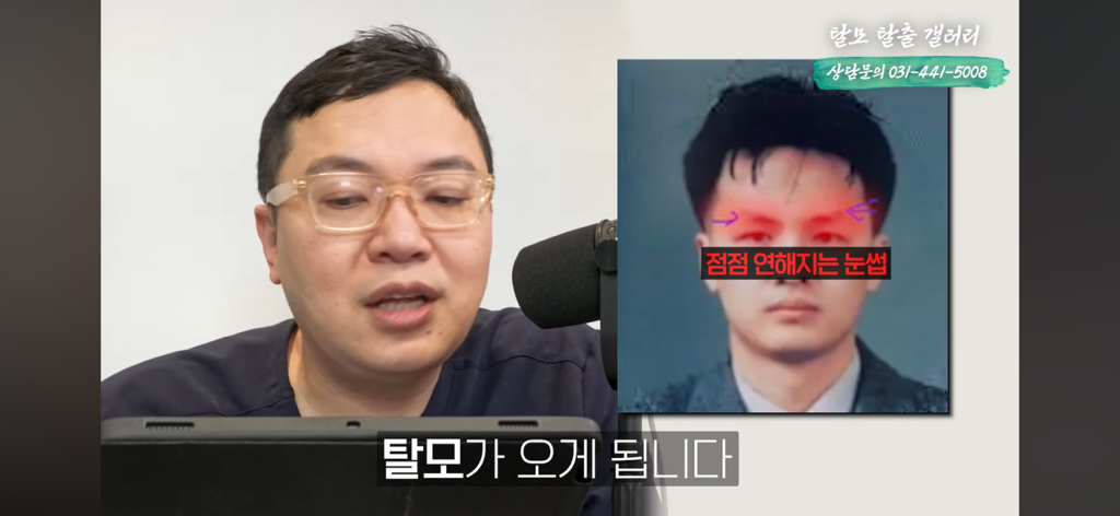 탈모 유튜버가 분석한 한동훈 | 인스티즈