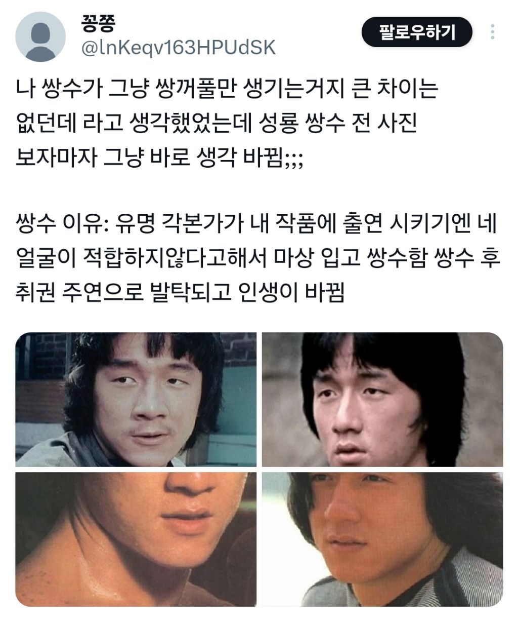 쌍꺼풀 수술한다고 큰 변화 없던데;;라고 생각했는데 | 인스티즈