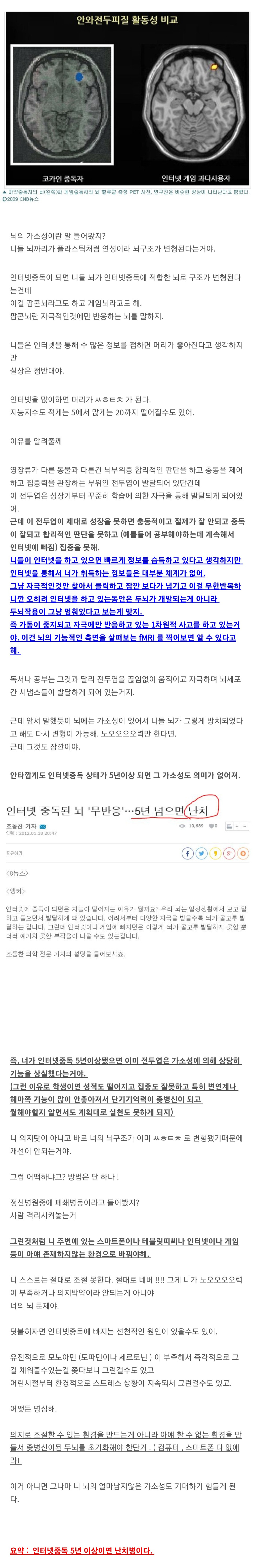  인터넷 중독 5년이상이면 뇌회복 불가.jpg2