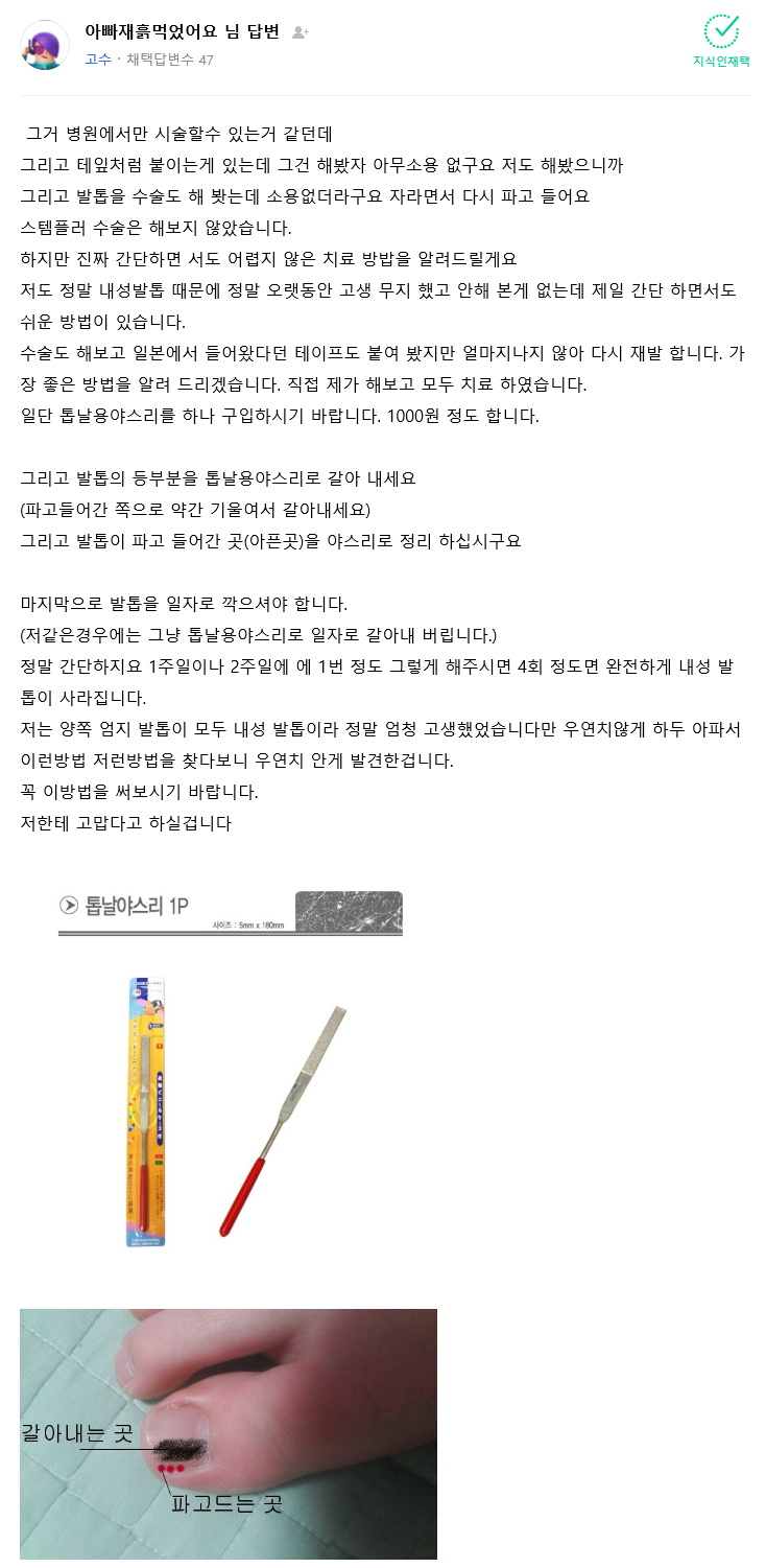 내성발톱으로 고통받는자를 구원하기 위해 신의 계시를 받은자.jpg | 인스티즈