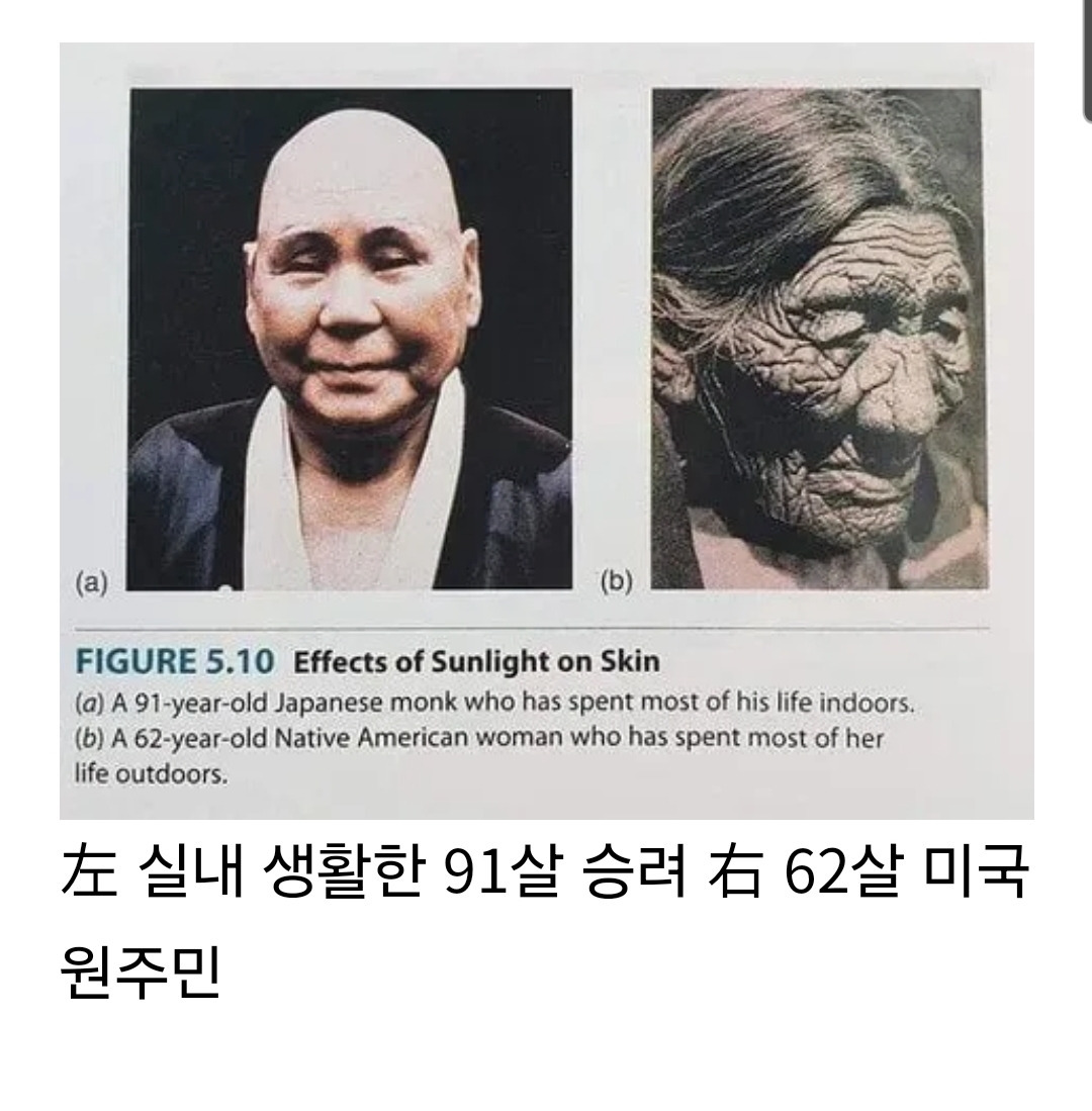 햇빛이 피부에 미치는 영향 사례 | 인스티즈