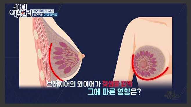 [바디 액츄얼리] 브래지어가 여성의 몸에 미치는 영향 (브라VS노브라) | 인스티즈