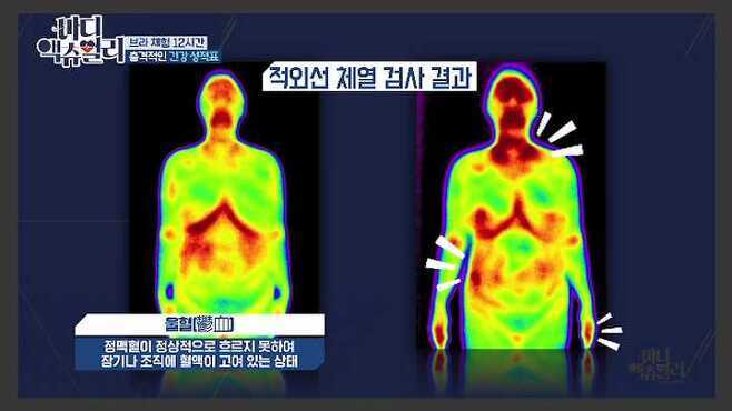 [바디 액츄얼리] 브래지어가 여성의 몸에 미치는 영향 (브라VS노브라) | 인스티즈