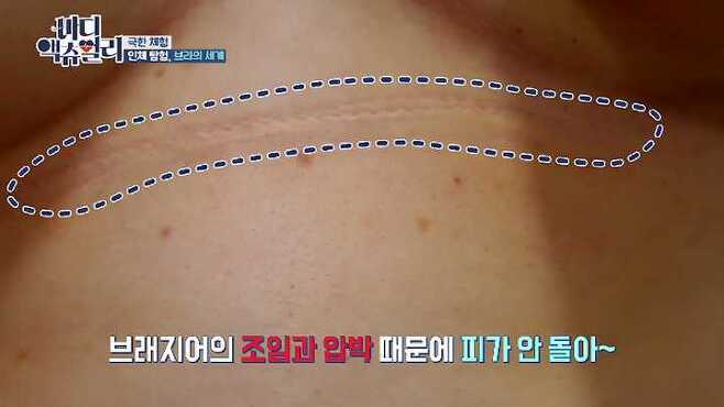 [바디 액츄얼리] 브래지어가 여성의 몸에 미치는 영향 (브라VS노브라) | 인스티즈