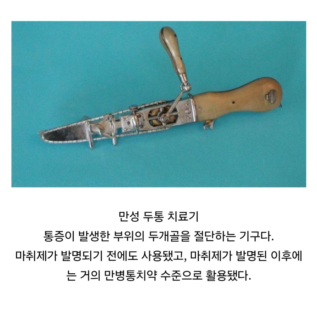 옛날에 사용됐다는 만성 두통 치료기