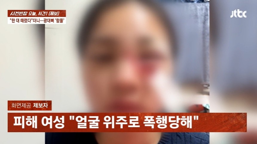  폭행당한 여친 기절하자 모텔로 질질…한밤 길거리서 끔찍 사건