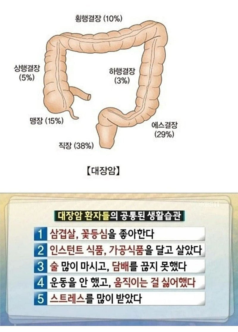  대장암 환자들의 공통된 생활습관