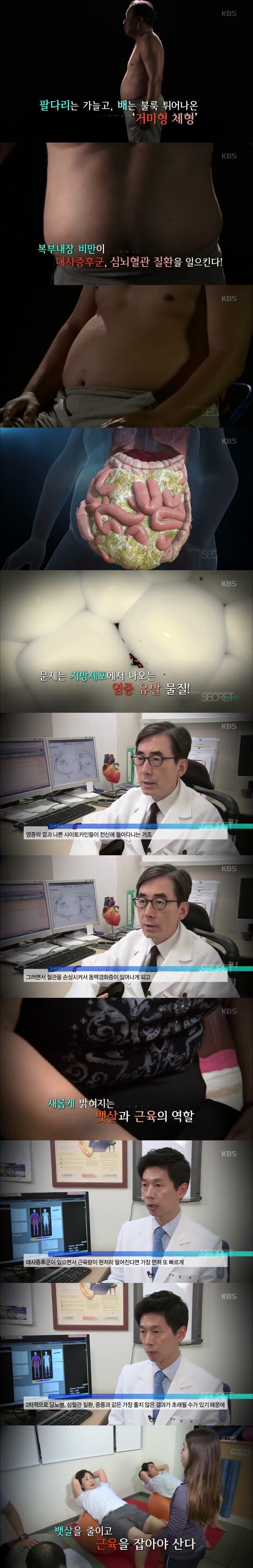 의사들 : 팔다리 지방은 비교적 안 해롭고 복부 지방은 심각하게 해롭다.jpg | 인스티즈