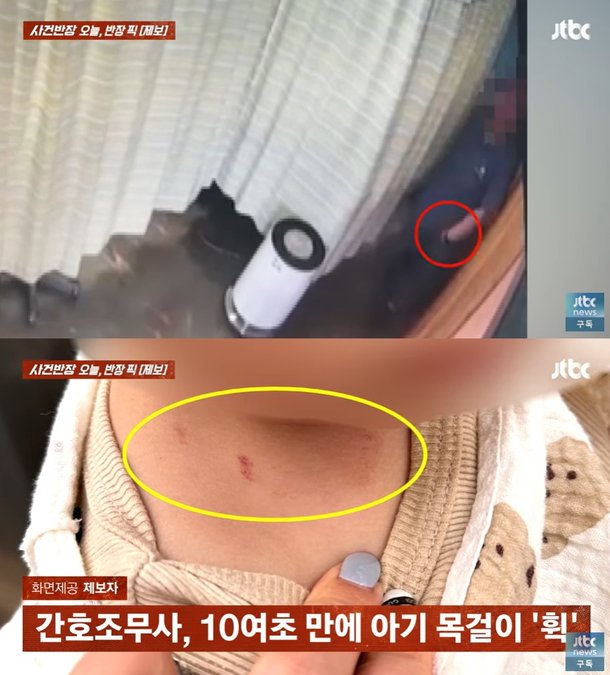 수액 맞는 아기 금목걸이 휙 빼간 간호조무사…목에 상처도 냈다 | 인스티즈