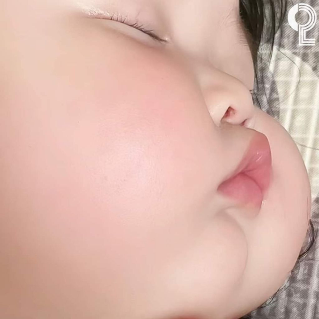 아기 볼살 | 인스티즈