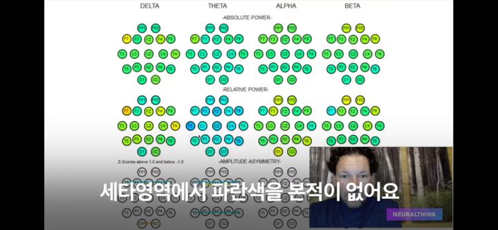 도파민 디톡스 7일이면 뇌가 변함! | 인스티즈