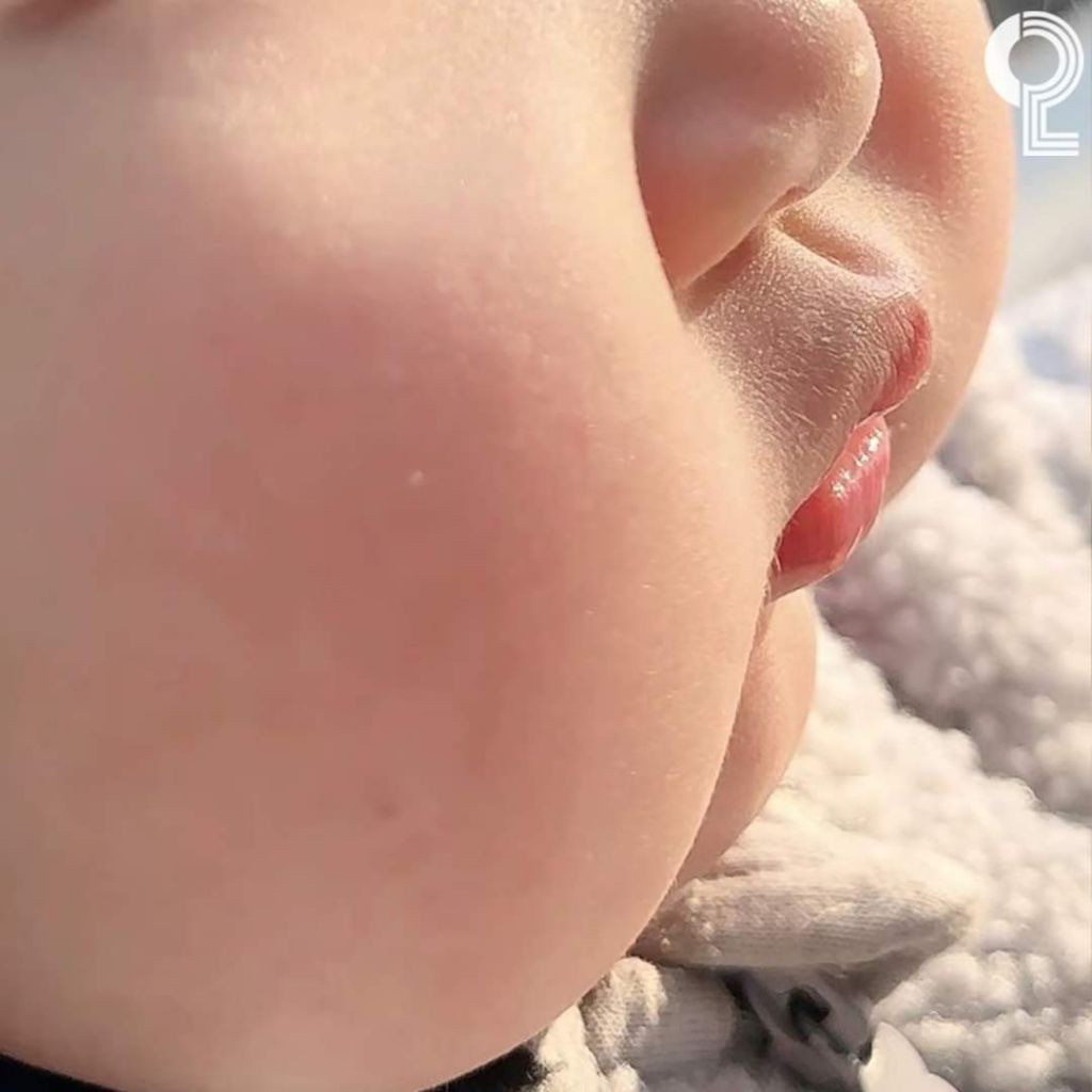 아기 볼살 | 인스티즈