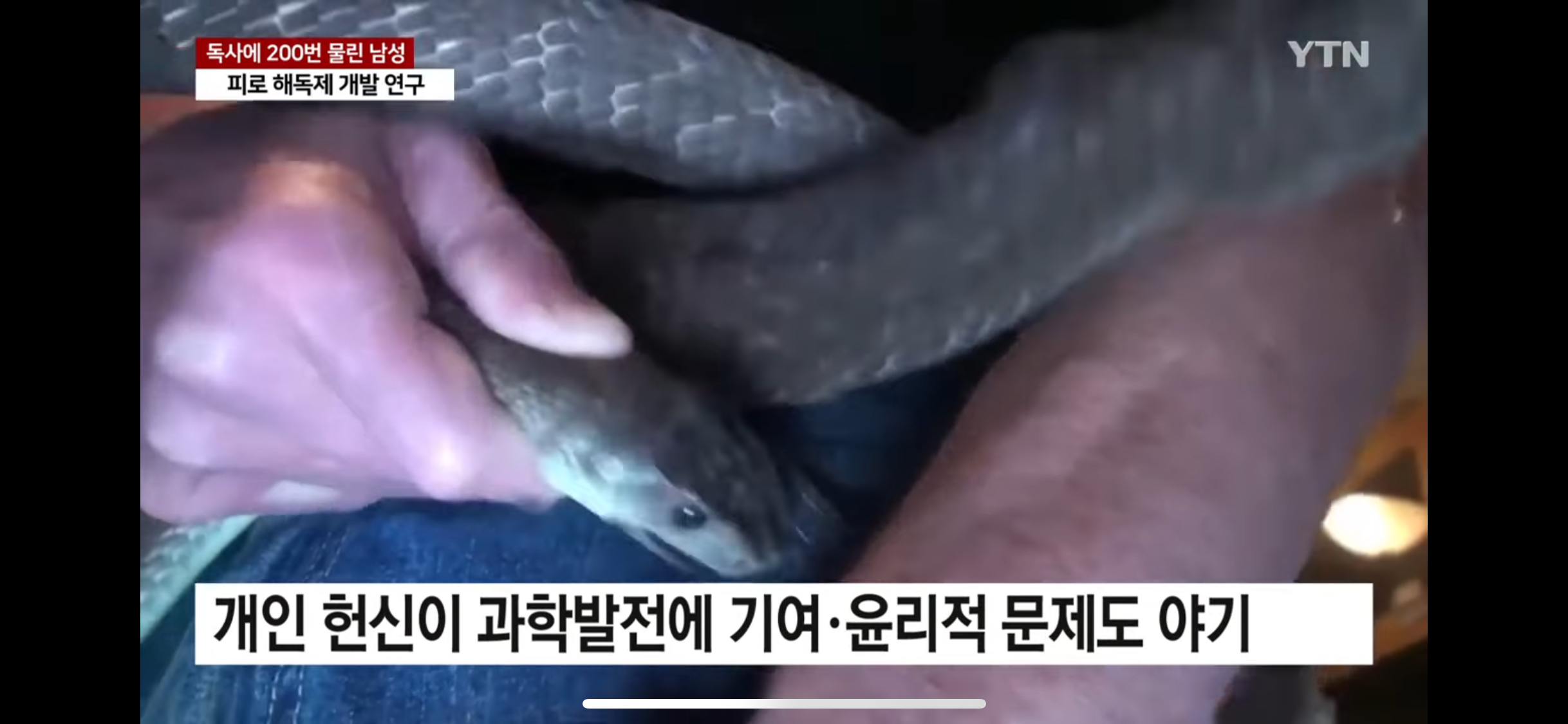 독사에 200번 물린 남성 피로 해독제 개발 | 인스티즈