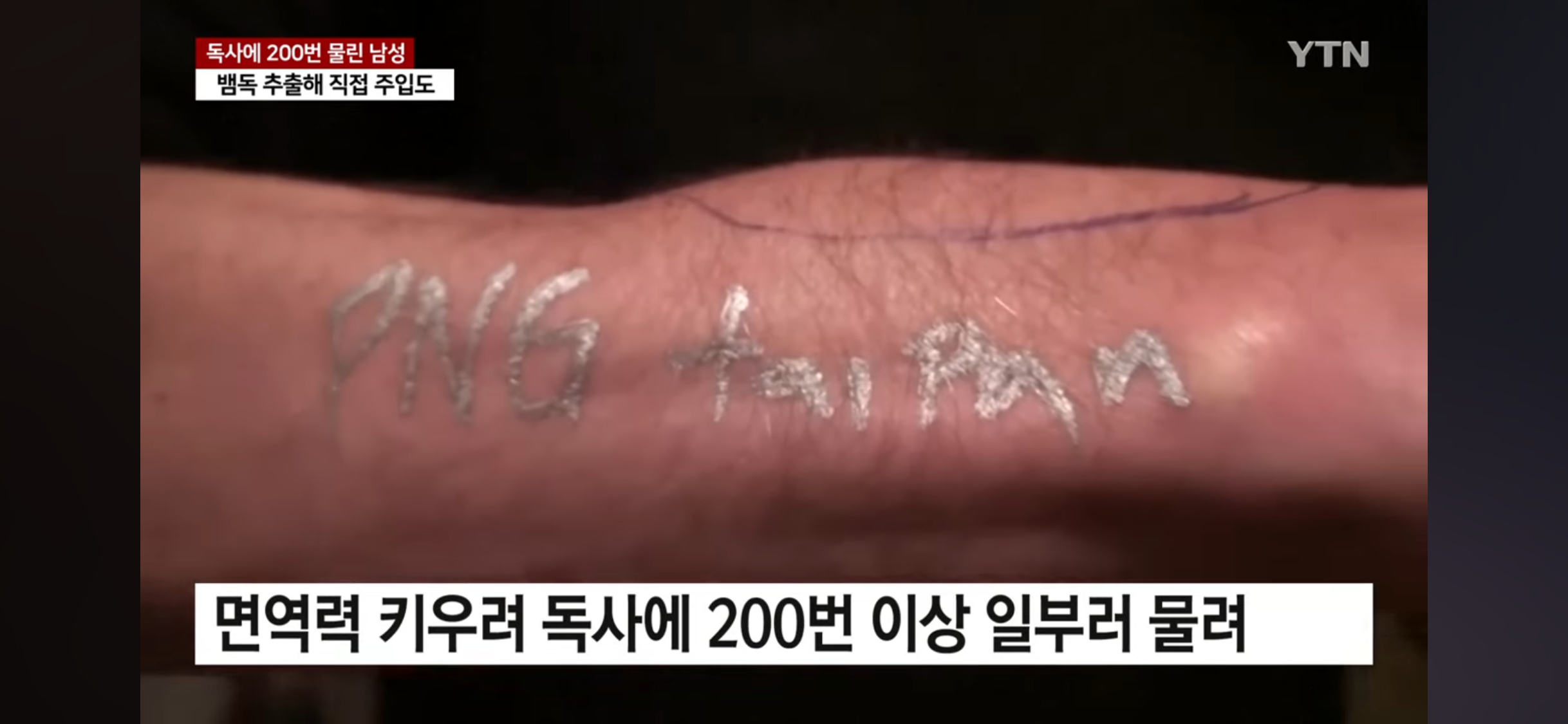  독사에 200번 물린 남성 피로 해독제 개발