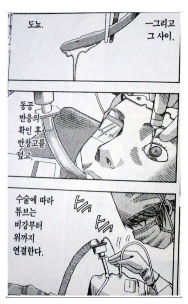 전신마취하는 과정 | 인스티즈