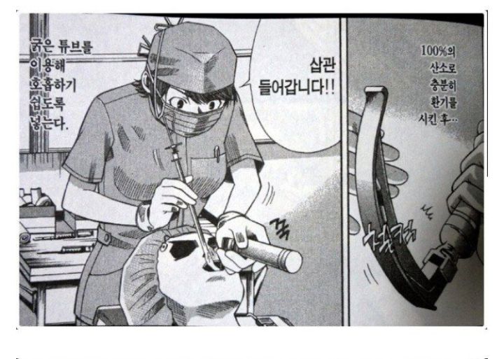 전신마취하는 과정 | 인스티즈