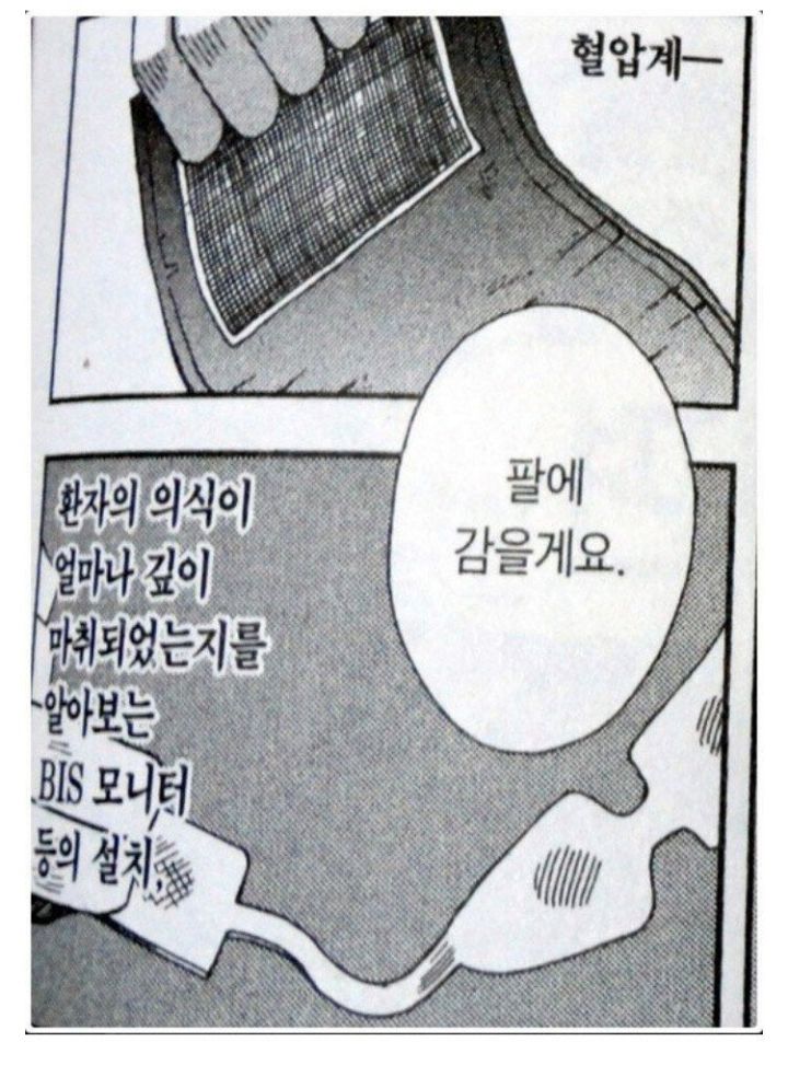 전신마취하는 과정 | 인스티즈