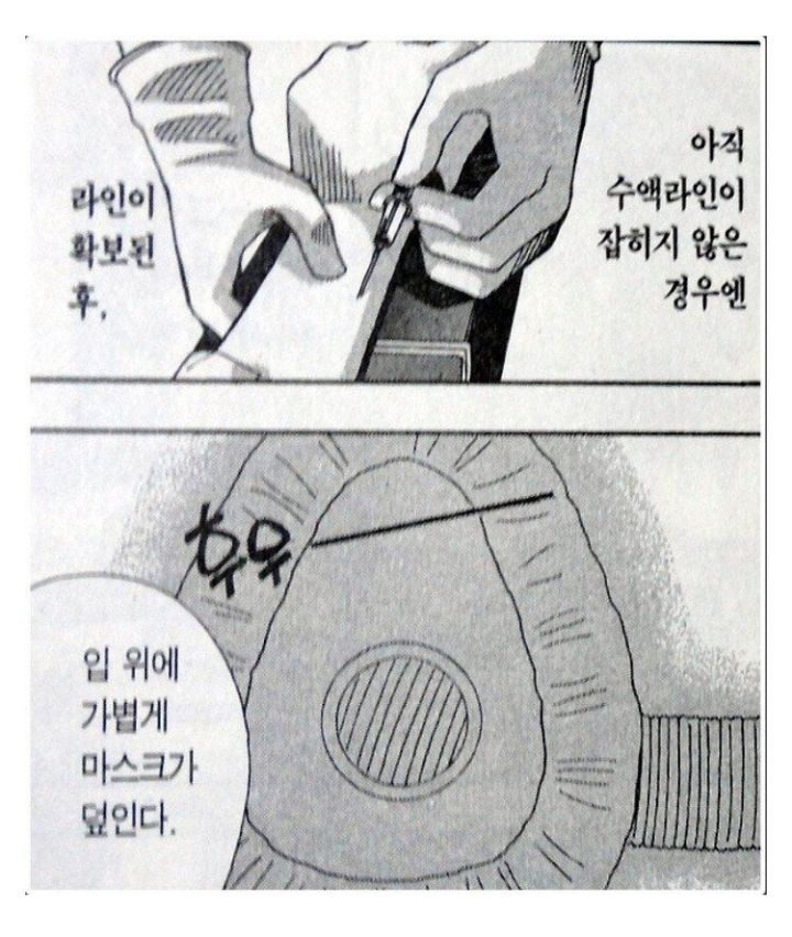 전신마취하는 과정 | 인스티즈
