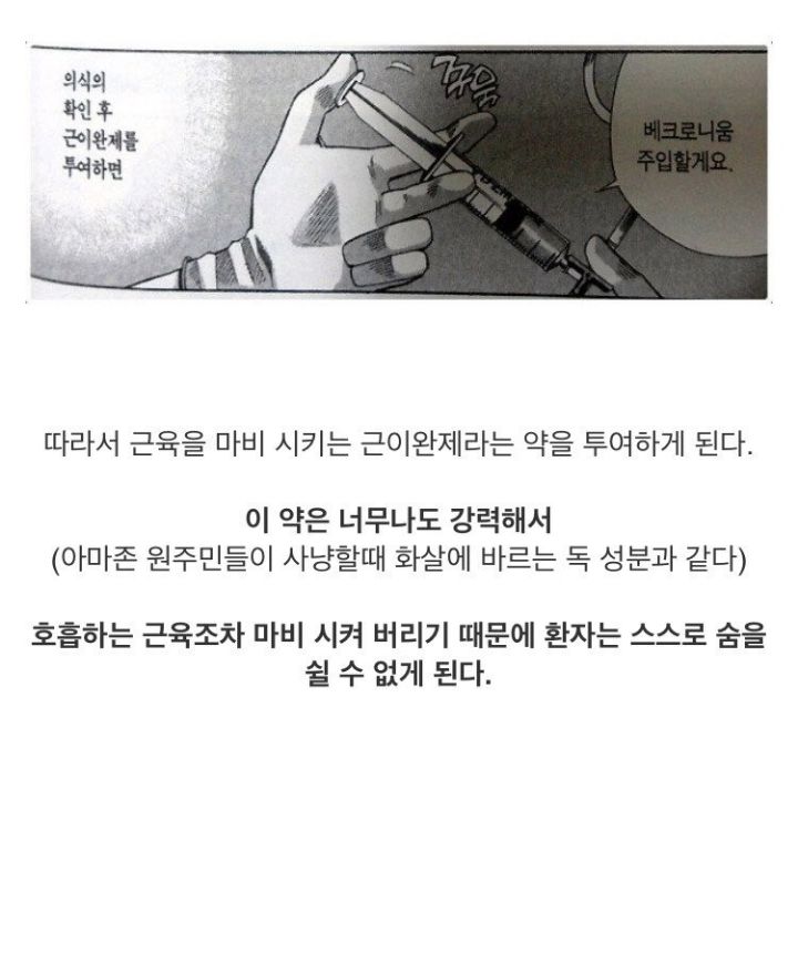 전신마취하는 과정 | 인스티즈