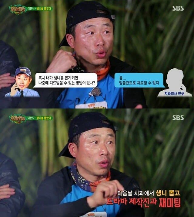 배역을 위해 생니 뽑는 고통을 참은 배우 이문식 | 인스티즈