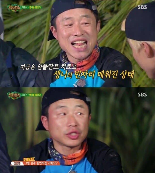 배역을 위해 생니 뽑는 고통을 참은 배우 이문식 | 인스티즈