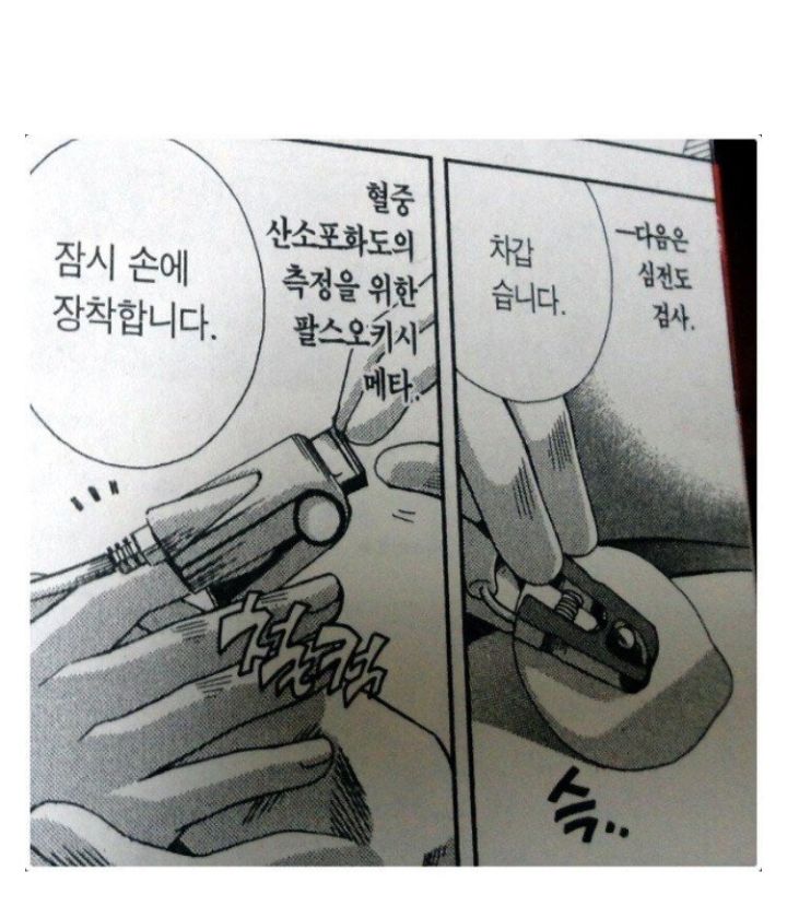 전신마취하는 과정 | 인스티즈