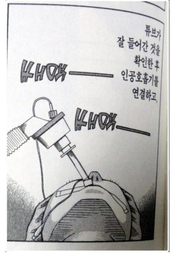 전신마취하는 과정 | 인스티즈