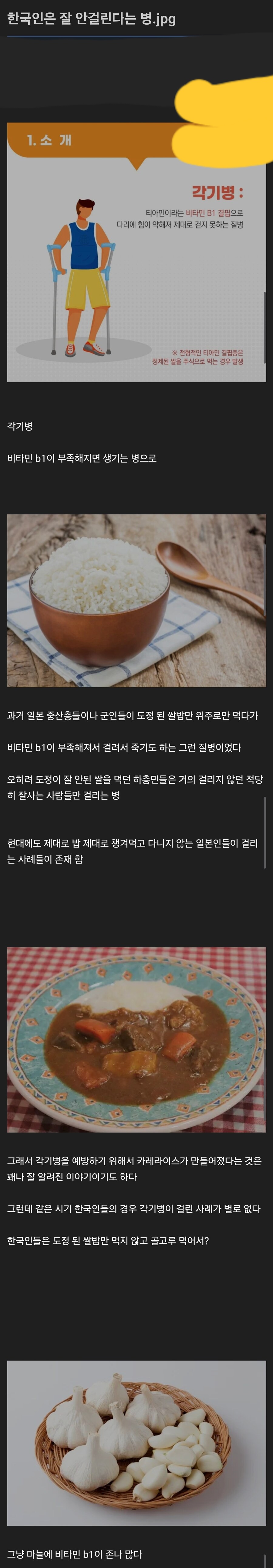  한국인은 잘 안걸리는 병