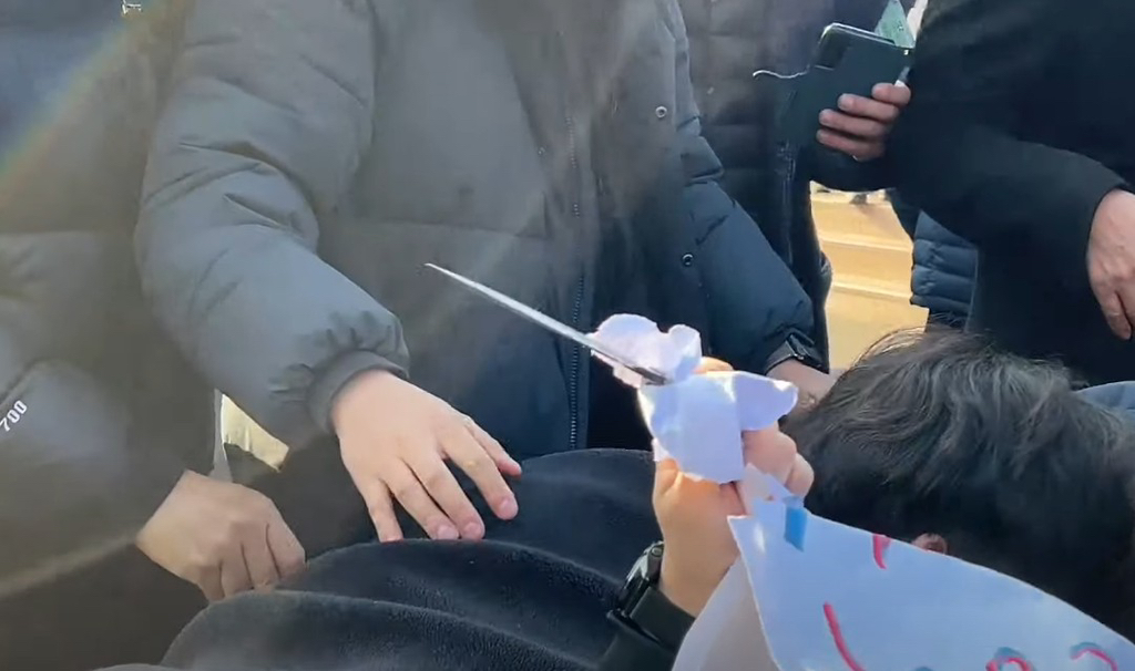 (주의) 어제 토론 보고 찾아본, 정말 죽다 살아나온 듯한 이재명 목 흉터와 피습 사진 | 인스티즈